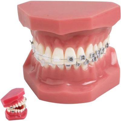 CEEBUS Dental Teeth Orthodontic Model with Metal and Ceramic Brackets Oral Demonstrating Models for Dentist To Communicate with Patients