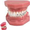 CEEBUS Dental Teeth Orthodontic Model with Metal and Ceramic Brackets Oral Demonstrating Models for Dentist To Communicate with Patients view 1