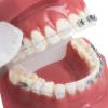 CEEBUS Dental Teeth Orthodontic Model with Metal and Ceramic Brackets Oral Demonstrating Models for Dentist To Communicate with Patients view 2