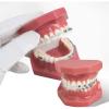 CEEBUS Dental Teeth Orthodontic Model with Metal and Ceramic Brackets Oral Demonstrating Models for Dentist To Communicate with Patients view 3