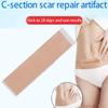 3PC Efficient Surgery Removal Silicone Sheet for Acne Trauma Burn Repair Treatment view 2