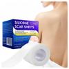 4x300cm (2Pcs) Silicone Patch Treatment Wounds Cover Tape Caesarean Section Burn Acne Sheet Beauty Skin Repair view 1