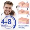 4x300cm (2Pcs) Silicone Patch Treatment Wounds Cover Tape Caesarean Section Burn Acne Sheet Beauty Skin Repair view 3