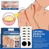 M-EDix Lipoma Removal Patch,Lymphatic Care Patch,Soothe Body Fat Knots and Dissolve Lumps,Lymphatic Drainage Patch Herbal Lymph Care Patch,Get Rid of Fatty Lipoma Lumps (24pcs) view 2
