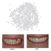 Jojomis Thermal Beads Teeth Veneers Moldable Denture Temporary Tooth Repair Kit, used for broken teeth, big gaps, uneven teeth and missing teeth. - 20g view 2