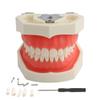 Teeth Model Detachable Dental Tooth Model with 28 Teeth, Dental Typodont Teeth Model for Dental Students, Patient Education, Display view 1