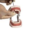 Teeth Model Detachable Dental Tooth Model with 28 Teeth, Dental Typodont Teeth Model for Dental Students, Patient Education, Display view 3