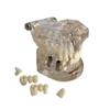 Dental Implant Disease Teeth Model Transparent Tooth Pathological Model Removable Teeth Neural Repair Dental Teeth Model for Patient Education view 3