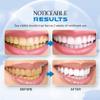 Dazzlewhite Teeth Whitening Essence,Teeth Whitening Essence Extra Strong White Hygiene Tooth,Intensive Stain Removal Teeth Reduce Yellowing (2pcs) view 3