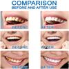 Dazzlewhite Teeth Whitening Essence,Teeth Whitening Essence Extra Strong White Hygiene Tooth,Intensive Stain Removal Teeth Reduce Yellowing (3pcs) view 4