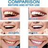 Dazzlewhite Teeth Whitening Essence,Sensitive Teeth Whitening Essence Liquid,Natural Instant Teeth Stain Remover to Whiten Teeth (3pcs) view 4