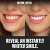 Spotlight Oral Care Teeth Whitening Powder - Made by Dentists | PAP+, Hydroxyapatite & Diamond Powder | Non-Abrasive & Enamel-Safe | Suitable for Sensitive Teeth & Dental Work | Instant Whitening view 3