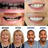 EMERZE Dentures Cosmetic Veneer Natural Tone Instant Veneers Dental Silicone Tooth Whitening Temporary Prosthesis Teeth Top Bottom False Teeth Men And Women Dental Prostheses,7 pairs view 4