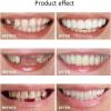 EMERZE Dentures Cosmetic Veneer Natural Tone Instant Veneers Dental Silicone Tooth Whitening Temporary Prosthesis Teeth Top Bottom False Teeth Men And Women Dental Prostheses,8 pairs view 3