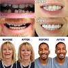 EMERZE Dentures Cosmetic Veneer Natural Tone Instant Veneers Dental Silicone Tooth Whitening Temporary Prosthesis Teeth Top Bottom False Teeth Men And Women Dental Prostheses,8 pairs view 4