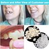 Fake Tooth Repair kits for Filling The Missing Broken Tooth and Gaps-Moldable and False Teeth Thermal Beads Replacement Kits view 2