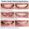 1 Pair Temporary Cosmetic Teeth Denture Teeth Cosmetic Simulated Braces Upper Braces + Lower Braces, Whitening Teeth Snap Cap On Instant Comfortable view 2