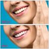 4 Pieces Instant Veneers Dentures Fake Teeth Smile Serrated Denture Top Bottom Temporary False Teeth view 4