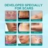 2Pcs Scar Removal Advanced Scar Spray, ScarRemove Advanced Scar Spray for All Types of Scars - Especially Acne Scars, Surgical Scars and Stretch Marks view 4