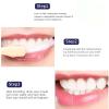 Whitening Toothpaste Fresh Breath Niacinamide Teeth Whitening Toothpaste Strong Stain Removing Toothpaste view 2