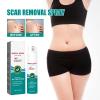 DUBUSH Scarremove Advanced Scar Removal Spray Facial Acne Scar Spray Removes Old and New Scars in Just 2 Weeks view 3