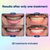 Sefid Smile Teeth Whitening Kit + LED  56 Strips, 28 Whitening Treatments  30 Toothpaste Tablets  Sensitivity Free  Enamel Safe  Rapid White Results  Professional Stain Removal for Home Use view 3