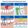 TePe Interdental Brush Angle, Angled Dental Brush for Teeth Cleaning, Pack of 25, 0.45 mm, Extra-Small/Small Gaps, Orange, Size 1 view 3