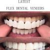 2 Pairs Instant Veneers Dentures Cosmetic Fake Teeth Braces Whitening Cosmetic Tooth Covering Snap On Teeth Top and Bottom Clip in Veneers Teeth Temporary Upper and Lower False Teeth for Men Women view 2