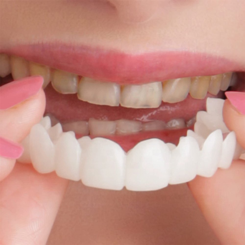 2 Pairs False Teeth Veneers Snap in Teeth, Upper and Lower Smile Teeth Veneers Fake Teeth, Instant Veneers Dentures Temporary Whitening Cosmetic Teeth Braces for Men and Women