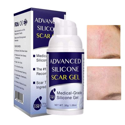 Scar Removal Gel Scars, Advanced Silicone Scar Gel, Scar Removal Cream For New & Old Scars Repair,C-Section, Stretch Mark, Surgical Scars Remover 1.06 Oz