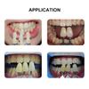 29 Colors Dental Shade Guide Teeth Whitening Shade Toothguide 3D Shades Teeth Bleach view 4
