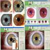 LMYYDES Iris Analysis Camera, 5.0 MP USB Iris Analyzer Iridology Camera with Pro Iris Software, Eye Iridology Camera for Beauty Salons, Health Clubs Iridology view 3