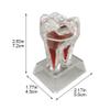 Casiler 4x Enlarged Tooth Model Figurine Educational Tooth Model Perfect for Dentistry Professionals & Students view 2