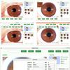 5.0 MP USB Iriscope Iris Analyzer Iridology Camera with pro Iris Software Eye Iriscope Iris Analyzer Analysis Iridology Camera for Beauty Salons, Health Clubs, Personal Health Management Centers view 4