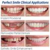 Giural 2 Pairs Instant Veneers Dentures Fake Snap in Teeth Temporary Cosmetic Teeth Smile Teeth Top Fake Teeth for Women and Men view 4