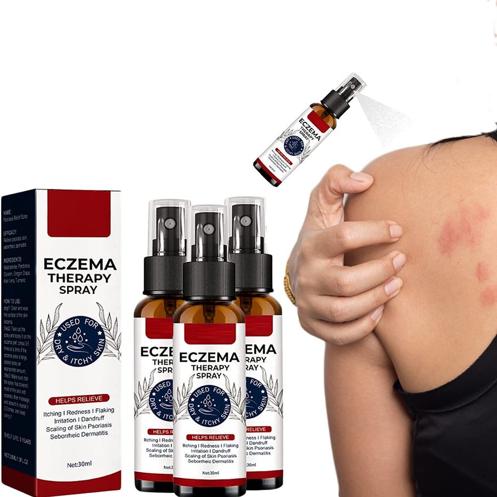 GFOUK Natural Eczema Therapy Spray,All Natural Eczema Treatment,Psoriasis Treatment,Vitiligo Skin Repair Spray,Skin Care Pain & Itch Spray,Fast Acting Itch Relief (3 Pcs)