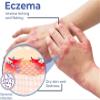 GFOUK Natural Eczema Therapy Spray,All Natural Eczema Treatment,Psoriasis Treatment,Vitiligo Skin Repair Spray,Skin Care Pain & Itch Spray,Fast Acting Itch Relief (3 Pcs) view 4