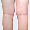 Healr Relief Legs Relief - Ideal Magnesium Spray for Restless Legs & Cramp Relief for Legs, Effective Liquid Magnesium for Leg Ache Relief, Swollen Legs Relief & Foot Spray for Tired Feet, 100ml view 3