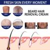 Hair Removal Cream,intimate Hair Removal Cream,intimate Hair Removal Cream for Women (5pcs,Men-60ml) view 3