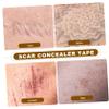 FOMIYES Flaw Concealer Tape for Body Makeup Waterproof Semi- Dark Skin Sticker Breathable Silicone Lightweight and Easy to Use for Spot and Scar Coverage view 2