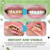 TLOPA Ampoule Toothpaste, TLOPA Ampoule Tooth Serum, Ampoule Essence Toothpaste, 3V Fruit Acid Teeth Whitening Disposable Essence, Removal of Tartar and Plaque (3BOX) view 3