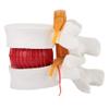 1:1.5 Medical Demon Ion Model of Lumbar Vertebral Spine Human Lumbar Disc Herniation Model Gonetre 14 * 13 * 12 e Dental Models view 1