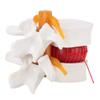 1:1.5 Medical Demon Ion Model of Lumbar Vertebral Spine Human Lumbar Disc Herniation Model Gonetre 14 * 13 * 12 e Dental Models view 3