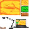 UZIAH Vein Finder Viewer Medical Vein Locator Detector Transilluminator Illumination Visualization Lights for Nurses, Caregivers Injection view 2
