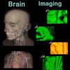 UZIAH Vein Finder Viewer Medical Vein Locator Detector Transilluminator Illumination Visualization Lights for Nurses, Caregivers Injection view 4