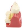 4 Times Dental Implant Model Enlarged Size Removable Analysis Crown Bridge Demonstration Teeth Model view 3