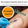Lipoma Removal Cream, HuangFuTang Lipoma Removal Cream,Lipoma Elimination Cream, MiaoZU HuangFuTang Lipoma Removal Cream, LumpFree Lipoma Removal Cream (2PC) view 3