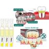 3V Fruit Acid Teeth Whitening Essence for Removal of Tartar and Plaque, Teeth Whitening Essence, Ampoule Essence Toothpaste (1PC) view 4