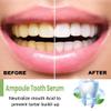 Ampoule Toothpaste, Ampoule Tooth Serum, Ampoule Essence Toothpaste,3v Fruit Acid Teeth Whitening Essence,Removal of Tartar and Plaque,Travel Friendly,Easy to Use (3box/30pcs) view 3