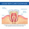 1/2/3 Pcs Loose Teeth Care Toothpaste, Gochicgolden Repair Toothpaste, Teeth Whitening Toothpaste, Anti-Cavity Teeth Cleaning Tooth Stains, 120g (A,1 Pcs) view 4